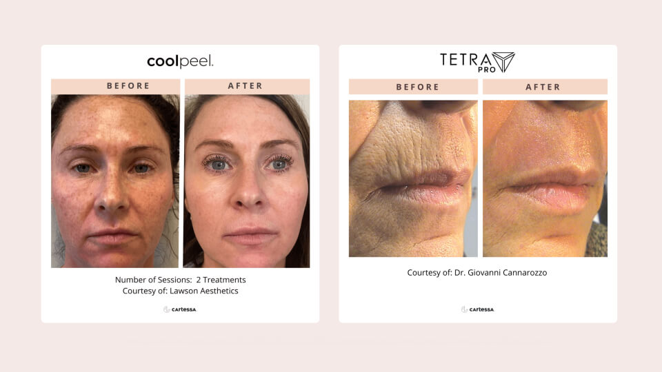 Tetra Pro: B&A Library