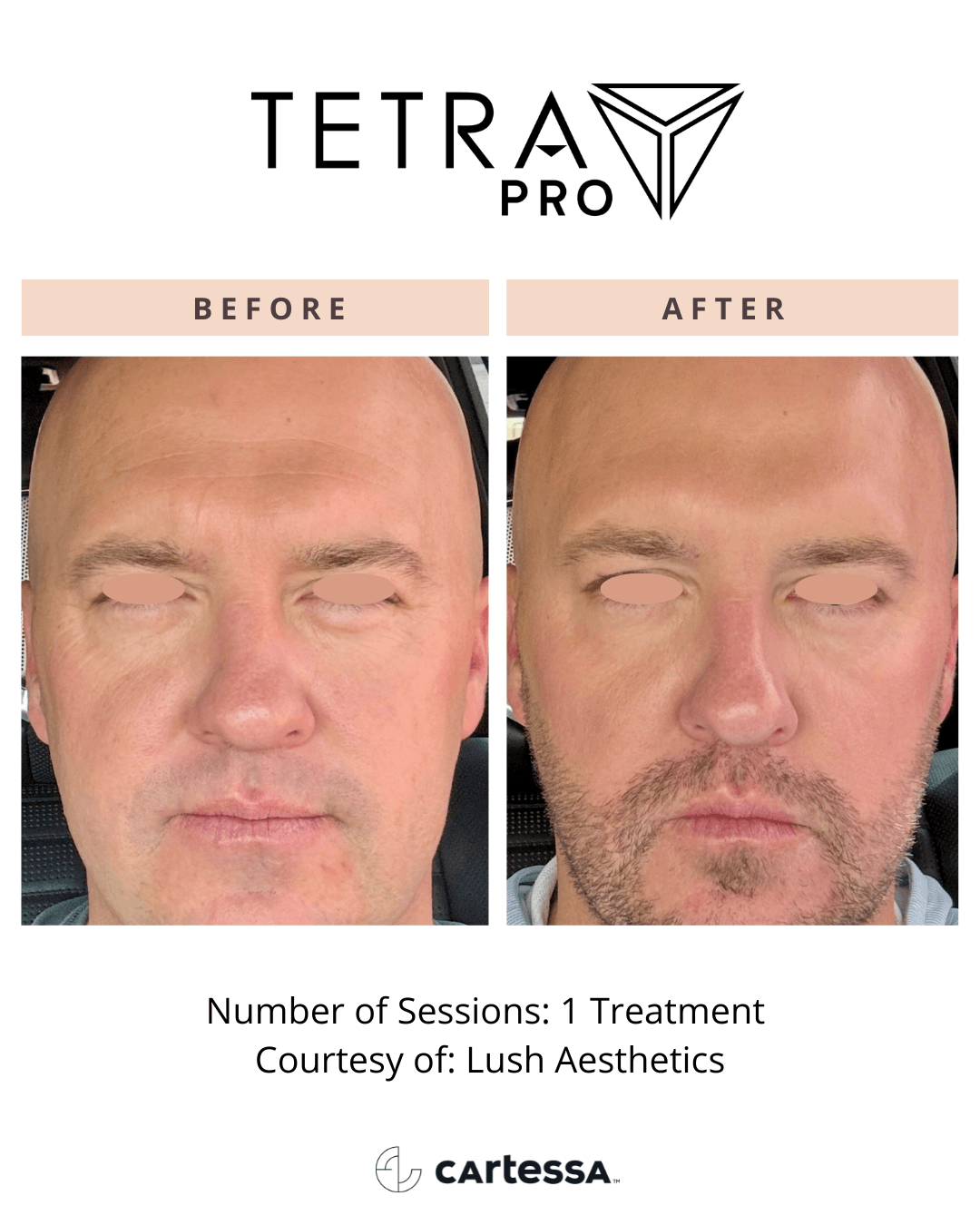 Tetra Pro B&A 01