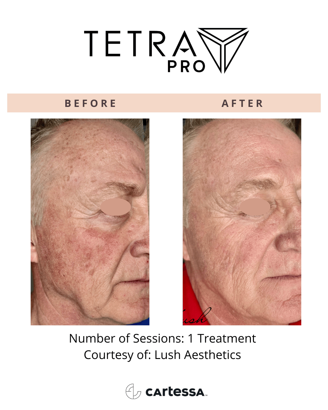 Tetra Pro B&A 02