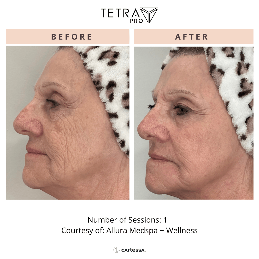 Tetra Pro B&A 06