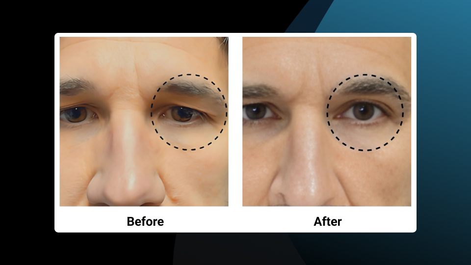 Before and After Imagery