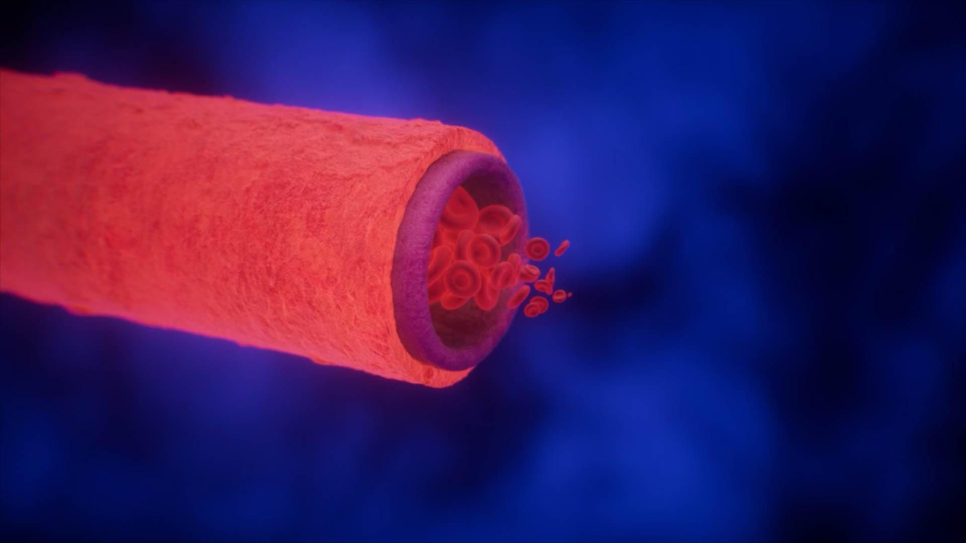 MDelite presentation render — 02